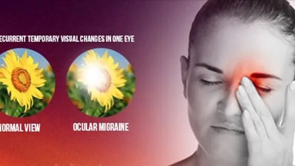 Ocular Migraine APK Screenshot